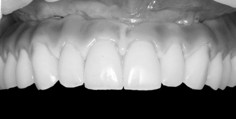 Dentida ir Ko